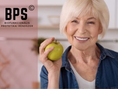 BPS prémium fogsor 1