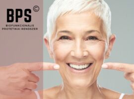 BPS prémium fogsor 5